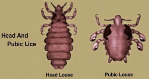 head-lice-and-pubic-lice1