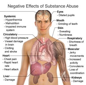 substance_abuse
